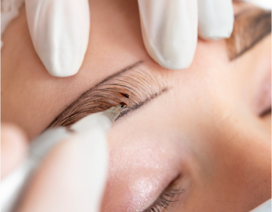 Microneedling : Tout ce qu’il faut savoir avant de se lancer